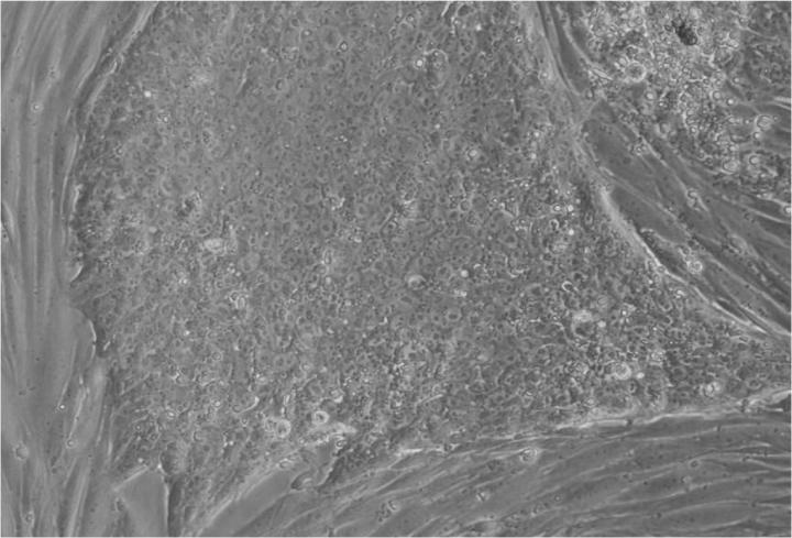 Embryonic stem cells