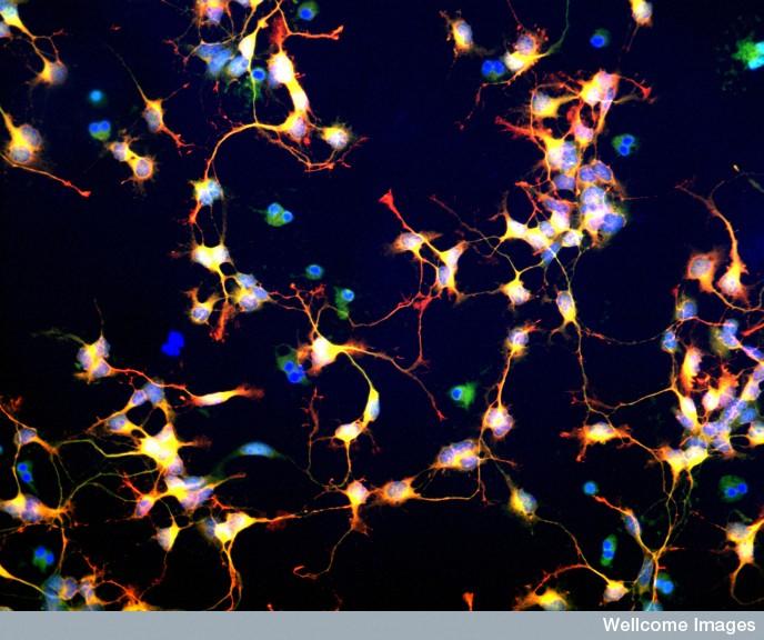 Differentiating neuroblasts