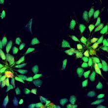 Neural rosettes
