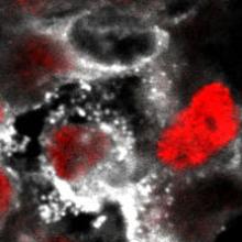 danstem stem cells diabetes