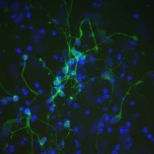 Reprogrammed skin cells